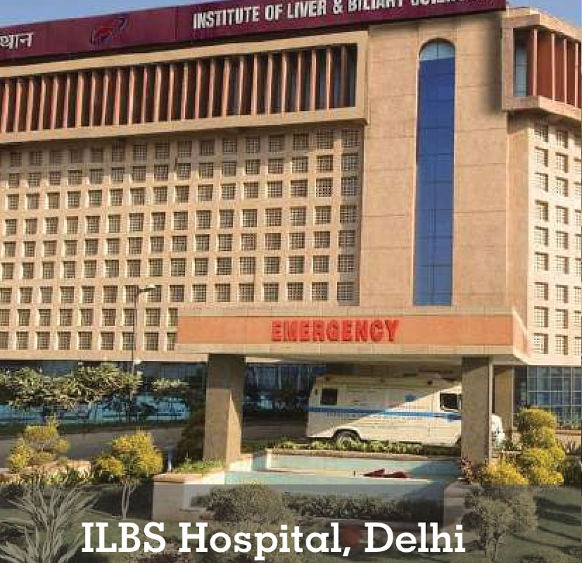 ILBS Hospital, Delhi